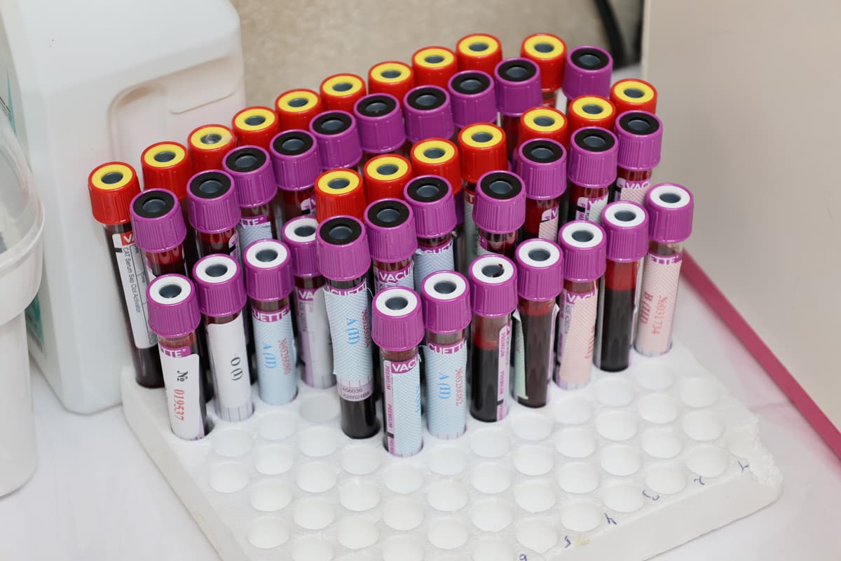 Basis-Gesundheits-Check-up
